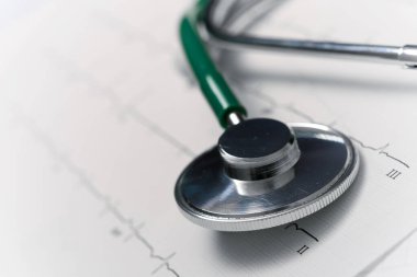 Bir elektrokardiyogram kağıt formu ve bir steteskop, yakın çekim.