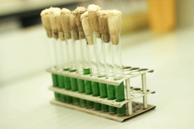 test tüpleri raflar, laboratuvar testi, laboratuvar muayene, laboratuvar testleri, laboratuvar analizi, test laboratuvarı