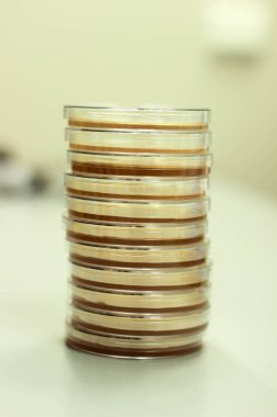 Petri dish, bakteriyolojik, laboratuvar çalışmaları