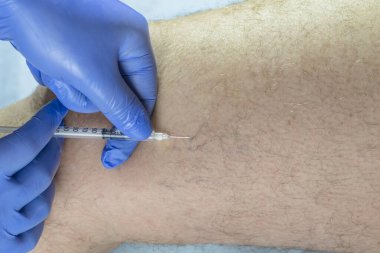 Doktor bir adamın bacağını muayene eder. Varisli damarlar var.