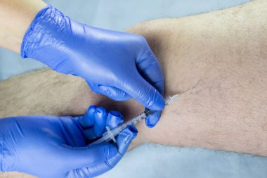 Doktor bir adamın bacağını muayene eder. Varisli damarlar var.