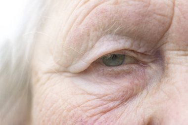 Yakın plan. Yaşlanmış kadın. Çerçevenin ortasında bir göz var. Gözbebeğinin odaklanması zayıftır, görme yetisi zayıftır, her şey bulanıktır.