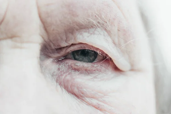Yakın plan. Yaşlanmış kadın. Çerçevenin ortasında bir göz var. Gözbebeğinin odaklanması zayıftır, görme yetisi zayıftır, her şey bulanıktır. — Stok fotoğraf