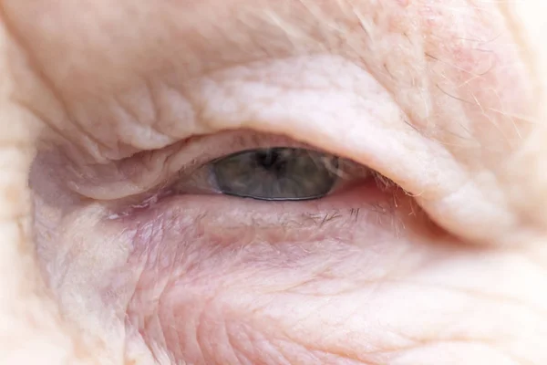 Close-up. Mulher envelhecida. Olho no centro da moldura. O aluno tem foco suave, o conceito de visão pobre, tudo está embaçado. — Fotografia de Stock