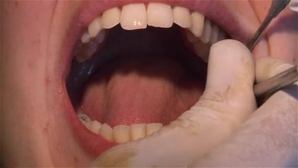 Bouche Une Femme Chez Dentiste — Video