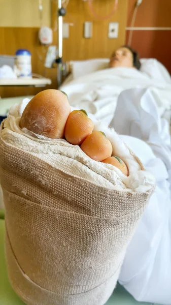 Vrouw in het ziekenhuis met bilaterale enkelfracturen die slapen na — Stockfoto