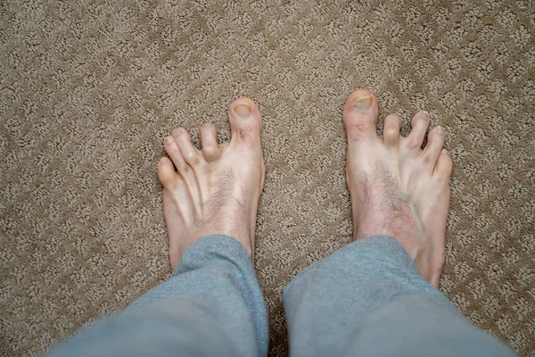 Erkekler ameliyattan önce ayak parmaklarını çekerler 