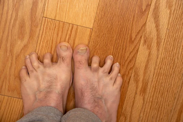 Erkekler ameliyattan önce ayak parmaklarını çekerler 