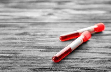 Test tüpleri ile kan örnekleri ahşap arka plan üzerinde