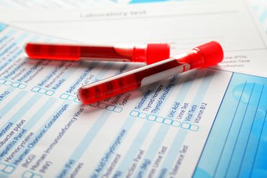 Formlar üzerindeki kan örnekleri ile test tüpleri