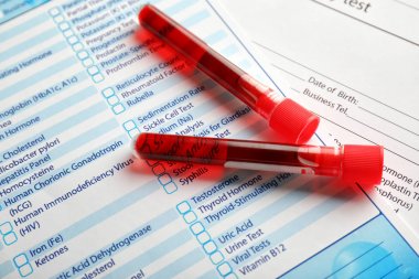 Formlar üzerindeki kan örnekleri ile test tüpleri