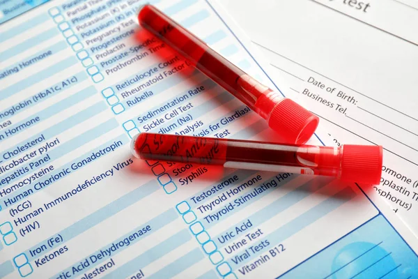 Formlar üzerindeki kan örnekleri ile test tüpleri