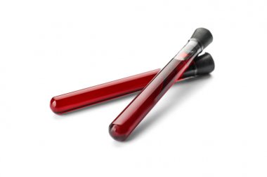 Beyaz arka plan üzerinde kan örnekleri ile test tüpleri