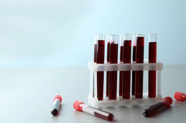 Masada kan örnekleri olan test tüpleri.