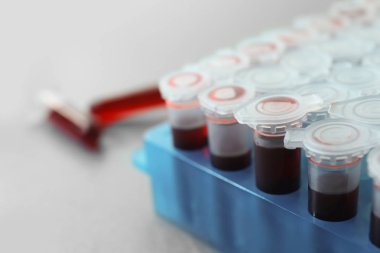 Kan örnekleri tutucu, closeup ile test tüpleri