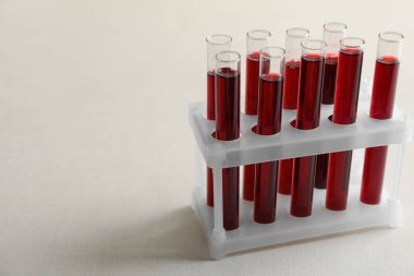 Kan örnekleri tutucu tablo ile test tüpleri