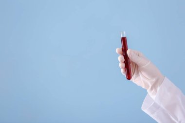 Tüp kan örneği ile renk arka plan üzerinde tutarak laboratuar işçisi