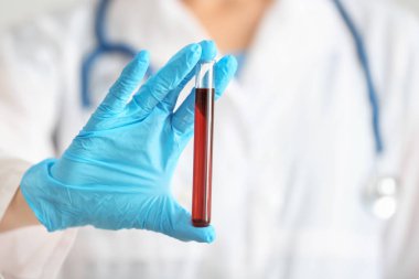 Tüp kan örneği, closeup ile tutan kadın