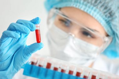 Kan örnekleri test tüpleri, closeup ile çalışan kadın