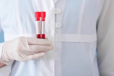 Test tüpleri kan örnekleri, closeup ile tutarak laboratuar işçisi
