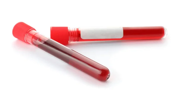 Tubos de ensayo con muestras de sangre sobre fondo blanco — Foto de Stock