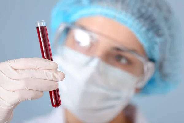 Woman holding test tube with blood sample, closeup — Stock Photo, Image