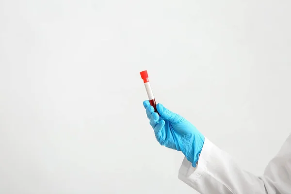 Lab worker holding test tube with blood sample on white background — Stock Photo, Image