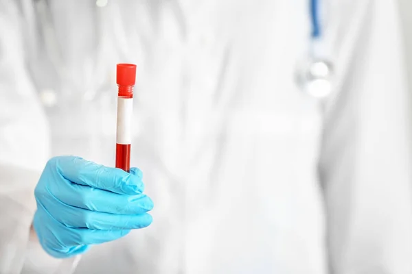 Woman holding test tube with blood sample, closeup — Stock Photo, Image