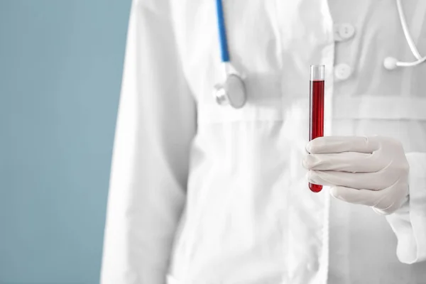 Mujer sosteniendo tubo de ensayo con muestra de sangre, primer plano — Foto de Stock