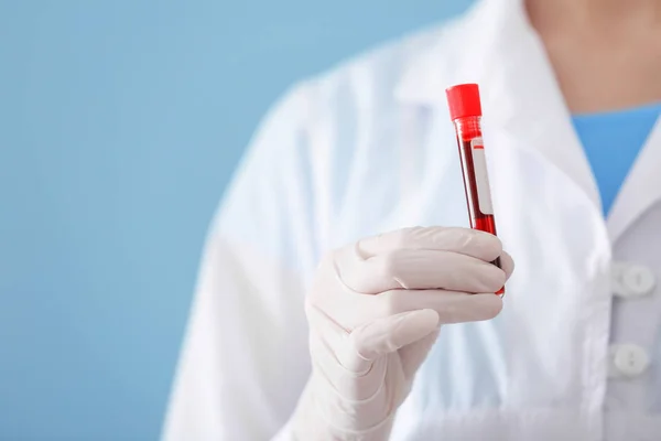 Lab worker holding test tube with blood sample on color background — Stock Photo, Image