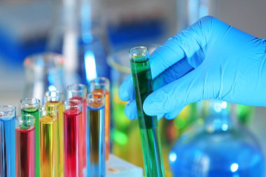 Tüp sıvı, closeup ile tutarak laboratuar işçisi