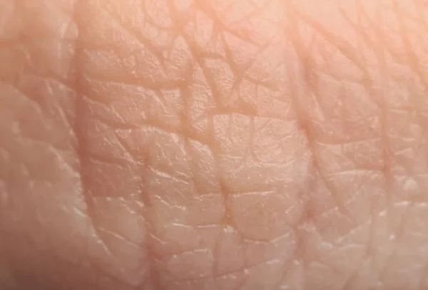 人类皮肤的结构，特写 — 图库照片