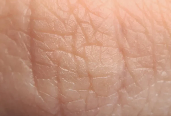 Texture of human skin, closeup — Stock Photo, Image