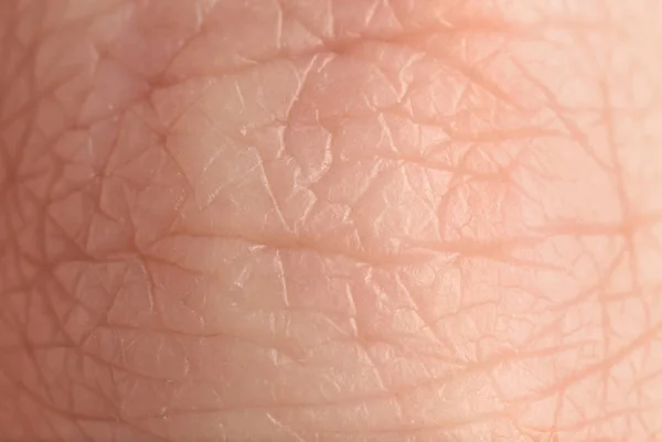 Texture of human skin, closeup — Stock Photo, Image