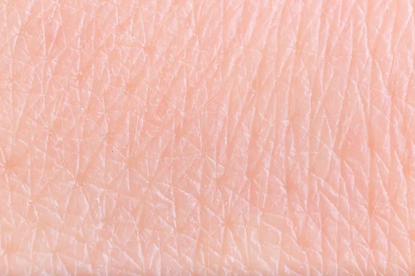 Texture of skin, closeup — Stock Photo, Image