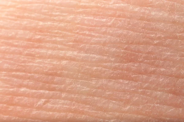 Texture of skin, closeup — Stock Photo, Image