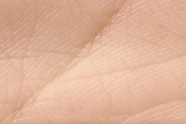 Texture of human skin, closeup — Stock Photo, Image
