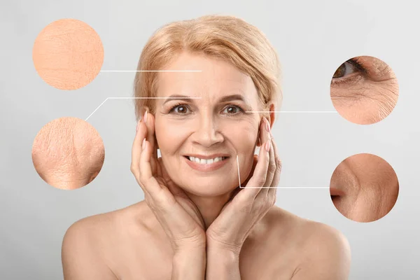 Beautiful mature woman with skin problem on light background. Process of aging — Stock Photo, Image