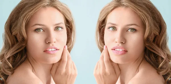 Mujer joven antes y después de la mejora de labios en el fondo de color —  Fotos de Stock