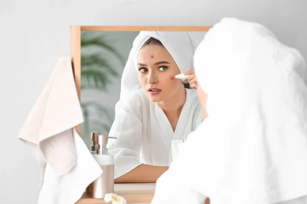 Portrait de jeune femme avec problème d'acné en utilisant un remède près du miroir — Photo