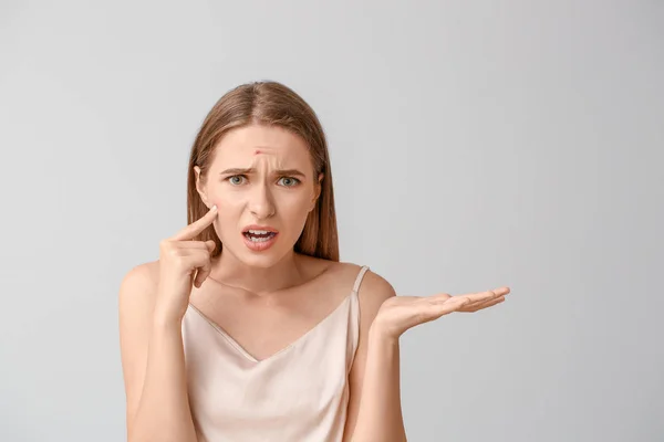 Portrait of young woman with acne problem on light background — Stock Photo, Image