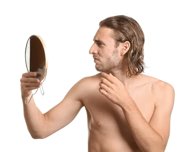 Portrait of young man with acne problem looking in mirror on white background — Stock Photo, Image