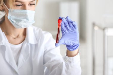 Laboratuvar asistanı klinikte üzerinde kan örneği olan test tüpünü tutuyor.