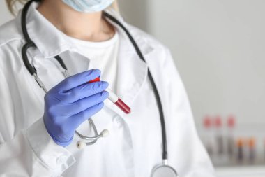 Laboratuvar asistanı test tüpünü klinikte kan örneğiyle tutuyor, yakın plan.