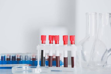 Kan örnekleri laboratuvar tablo ile test tüpleri