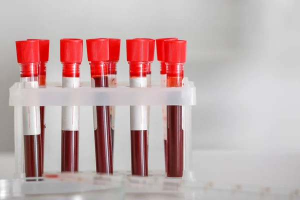 Test tubes with blood samples on table in laboratory — Stock Photo, Image