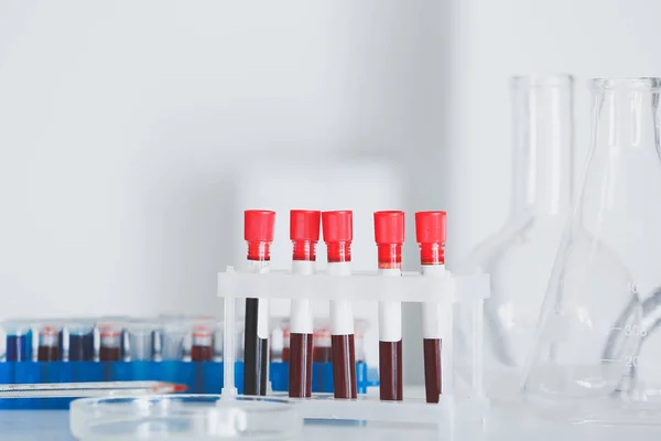 Test tubes with blood samples on table in laboratory — Stock Photo, Image