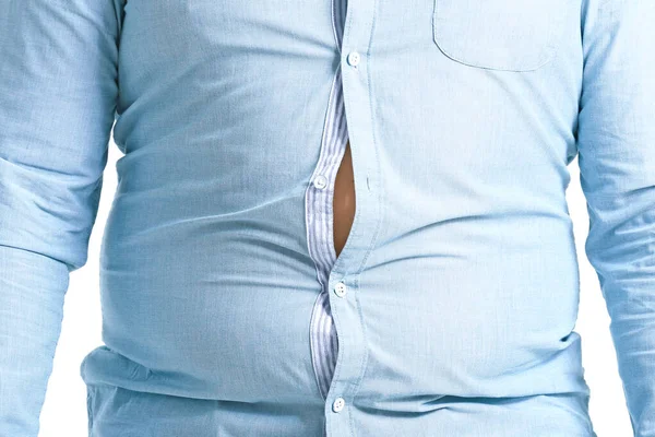 Uomo sovrappeso in abiti stretti, primo piano. Perdita di peso concetto — Foto Stock