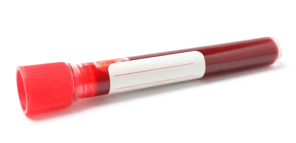 Tubo de ensaio com sangue sobre fundo branco — Fotografia de Stock