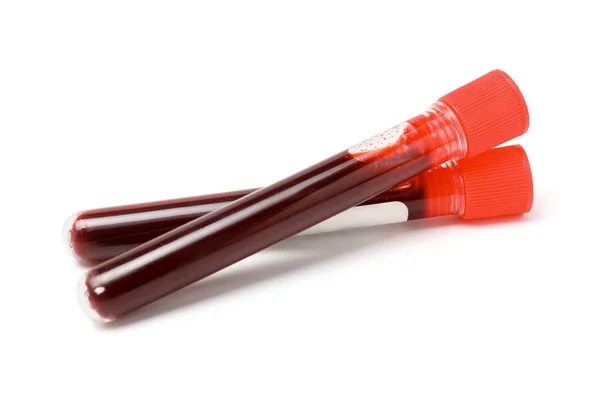 Tubos de ensaio com sangue sobre fundo branco — Fotografia de Stock